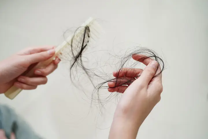 Tóc Rụng Bao Nhiêu Sợi Mỗi Ngày Là Bình Thường? Giải Đáp Chi Tiết Từ Chuyên Gia