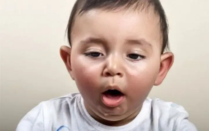 Bé 3 Tháng Nuốt Phải Tóc Có Sao Không? Dấu Hiệu Nhận Biết Và Cách Xử Lý An Toàn