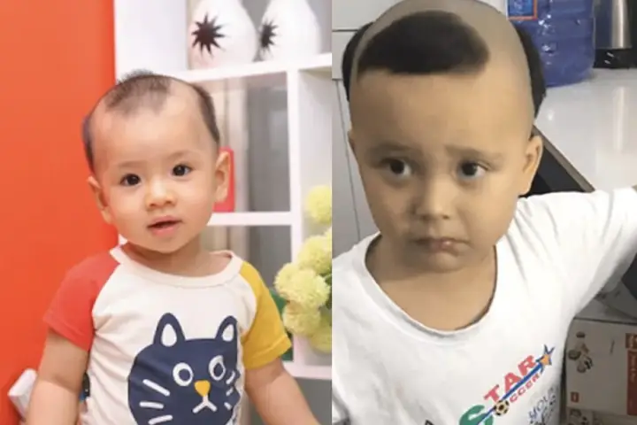 Bé Mọc Tóc Ba Chỏm: Ý Nghĩa Tâm Linh, Khoa Học Và Cách Chăm Sóc Tóc