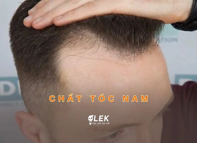 Nhận Diện & Chăm Sóc Các Loại Chất Tóc Nam: Hướng Dẫn Chi Tiết Cho Phái Mạnh Nhận Diện & Chăm Sóc Các Loại Chất Tóc Nam: Hướng Dẫn Chi Tiết Cho Phái Mạnh
