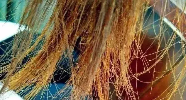 Các Vấn Đề Về Tóc Thường Gặp: Nguyên Nhân, Dấu Hiệu & Giải Pháp Toàn Diện Các Vấn Đề Về Tóc Thường Gặp: Nguyên Nhân, Dấu Hiệu & Giải Pháp Toàn Diện
