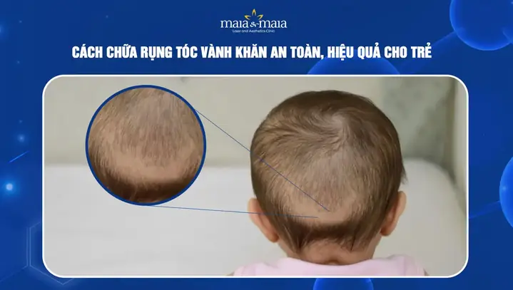 Cách Chữa Rụng Tóc Vành Khăn Ở Trẻ: Nguyên Nhân, Dấu Hiệu Và Giải Pháp Toàn Diện