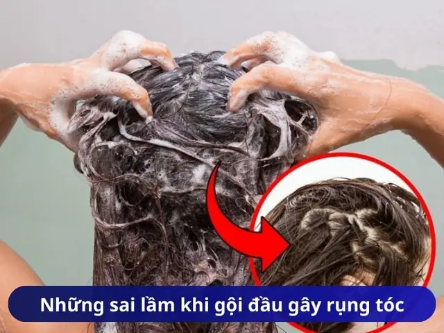 Cách Gội Đầu Đúng Cách Giảm Rụng Tóc Hiệu Quả | Bí Quyết Từ Chuyên Gia