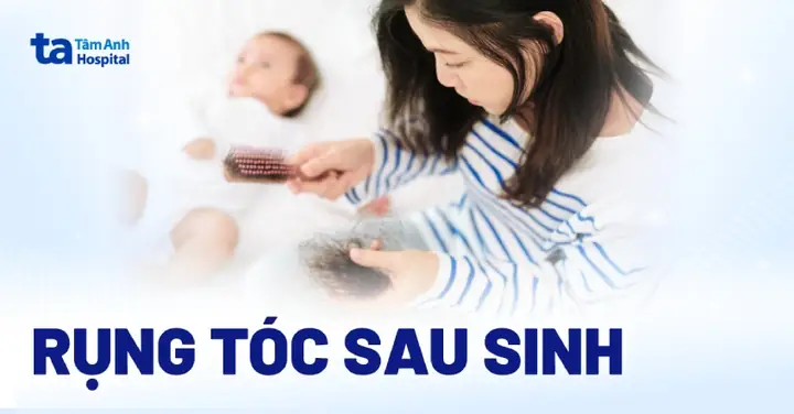 Cách Hạn Chế Rụng Tóc Sau Sinh An Toàn & Hiệu Quả Cho Mẹ Bỉm Sữa