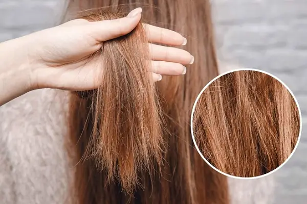 Bí Quyết Tóc Chắc Khỏe: 15 Cách Đơn Giản Ngăn Ngừa Tóc Chẻ Ngọn Tại Nhà Bí Quyết Tóc Chắc Khỏe: 15 Cách Đơn Giản Ngăn Ngừa Tóc Chẻ Ngọn Tại Nhà