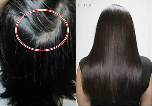 Tóc Bạc Thành Đen Tự Nhiên: Bí Quyết Phục Hồi Hiệu Quả Tại Nhà Không Cần Nhuộm