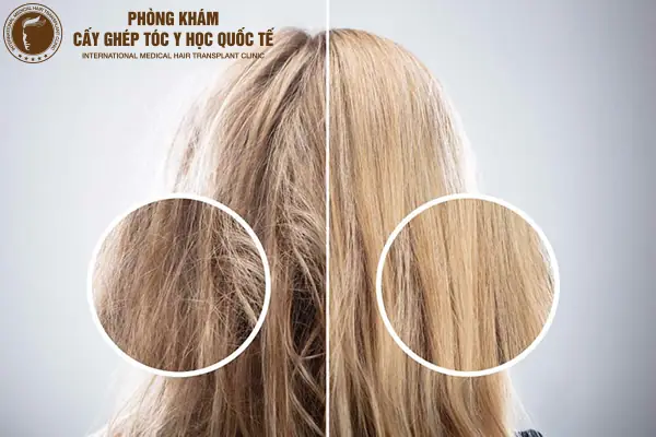 Bí Quyết Vàng: Cách Làm Tóc Hết Xơ Rối, Chẻ Ngọn & Phục Hồi Mềm Mượt Tự Nhiên Bí Quyết Vàng: Cách Làm Tóc Hết Xơ Rối, Chẻ Ngọn & Phục Hồi Mềm Mượt Tự Nhiên