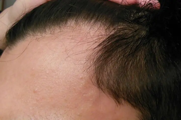 Nhận Biết Tóc Yếu: Dấu Hiệu, Nguyên Nhân Và Cách Phục Hồi Hiệu Quả Cho Mái Tóc Chắc Khỏe Nhận Biết Tóc Yếu: Dấu Hiệu, Nguyên Nhân Và Cách Phục Hồi Hiệu Quả Cho Mái Tóc Chắc Khỏe