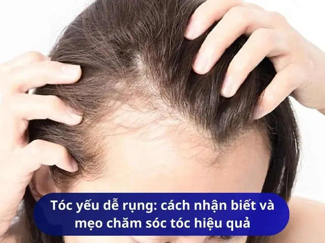 Nhận Biết Tóc Yếu: Dấu Hiệu, Nguyên Nhân Và Cách Phục Hồi Hiệu Quả Cho Mái Tóc Chắc Khỏe Nhận Biết Tóc Yếu: Dấu Hiệu, Nguyên Nhân Và Cách Phục Hồi Hiệu Quả Cho Mái Tóc Chắc Khỏe
