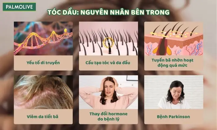 Cách Trị Da Đầu Dầu: Bí Quyết Tóc Suôn Mượt, Sạch Gàu Hiệu Quả