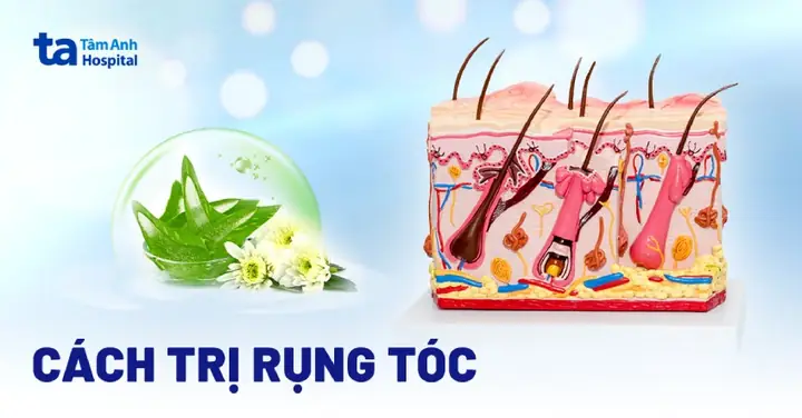 9+ Cách Trị Rụng Tóc Tại Nhà Nhanh Nhất & Tóc Mọc Dày Trở Lại 9+ Cách Trị Rụng Tóc Tại Nhà Nhanh Nhất & Tóc Mọc Dày Trở Lại
