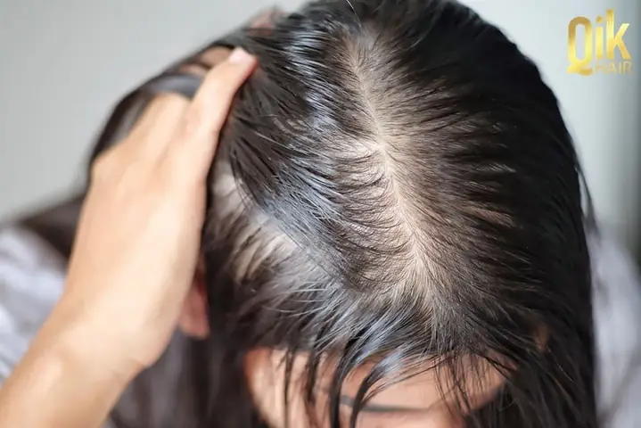 Bí Quyết Trị Tóc Mỏng Và Thưa: Nguyên Nhân, Giải Pháp & Cách Chăm Sóc Hiệu Quả Tại Nhà Bí Quyết Trị Tóc Mỏng Và Thưa: Nguyên Nhân, Giải Pháp & Cách Chăm Sóc Hiệu Quả Tại Nhà