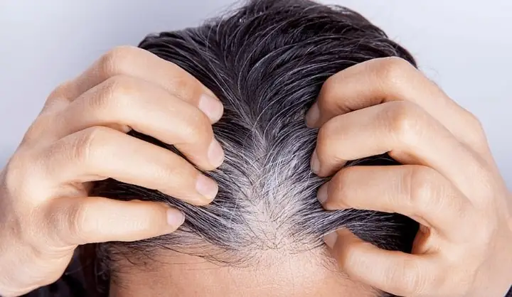 Cải Thiện Tóc Bạc Sớm: Nguyên Nhân, Cách Khắc Phục Và Phòng Ngừa Hiệu Quả Tại Nhà