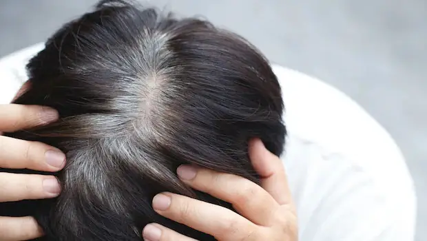 Cải Thiện Tóc Bạc Sớm: Nguyên Nhân, Cách Khắc Phục Và Phòng Ngừa Hiệu Quả Tại Nhà