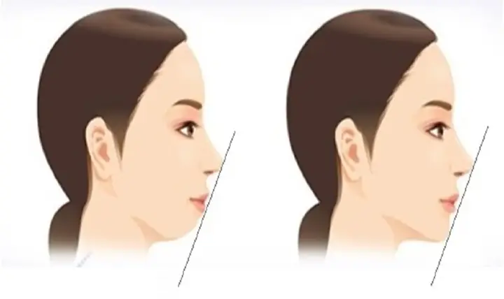 Cằm Lẹm Nên Để Tóc Gì? Top 15+ Kiểu Tóc Che Khuyết Điểm Hiệu Quả Cằm Lẹm Nên Để Tóc Gì? Top 15+ Kiểu Tóc Che Khuyết Điểm Hiệu Quả
