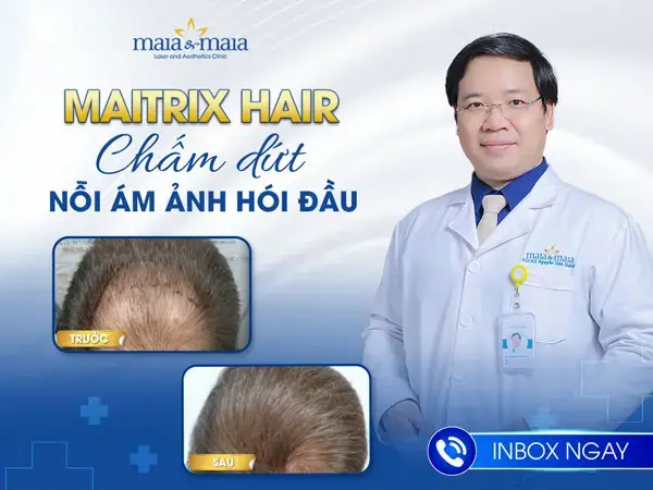 Cạo Đầu Bôi Vôi Tóc Có Mọc Lại Không? Giải Đáp Chi Tiết Và Lưu Ý Quan Trọng Cạo Đầu Bôi Vôi Tóc Có Mọc Lại Không? Giải Đáp Chi Tiết Và Lưu Ý Quan Trọng