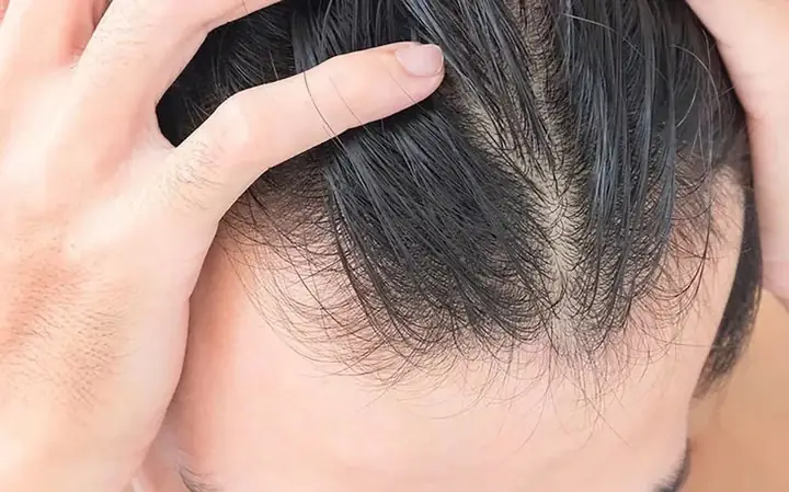 Cạo Đầu Tóc Có Mọc Nhiều Hơn Không? Sự Thật Về Niềm Tin Phổ Biến