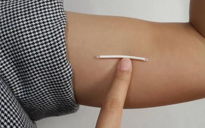 Cấy Que Tránh Thai Có Gây Rụng Tóc Không? Tìm Hiểu Tác Động Và Cách Khắc Phục