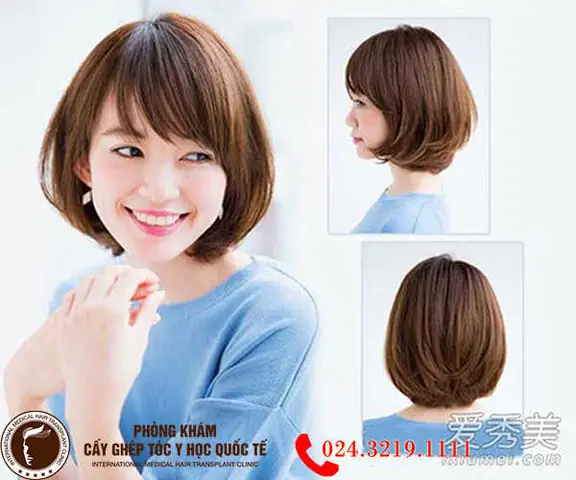 Cấy Tóc Cho Người Tóc Mỏng: Giải Pháp Hiệu Quả & Những Điều Cần Biết Cấy Tóc Cho Người Tóc Mỏng: Giải Pháp Hiệu Quả & Những Điều Cần Biết
