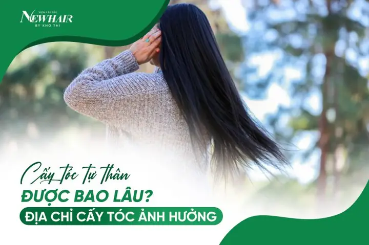 Cấy Tóc Tự Thân Được Bao Lâu? Hiệu Quả Vĩnh Viễn Hay Tạm Thời?