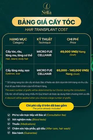 Cấy Tóc Tự Thân Giá Bao Nhiêu? Bảng Giá Chi Tiết & Yếu Tố Ảnh Hưởng 2026