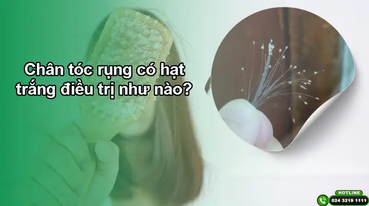 Chân Tóc Có Hạt Trắng: Nguyên Nhân, Dấu Hiệu Và Cách Khắc Phục Toàn Diện Chân Tóc Có Hạt Trắng: Nguyên Nhân, Dấu Hiệu Và Cách Khắc Phục Toàn Diện