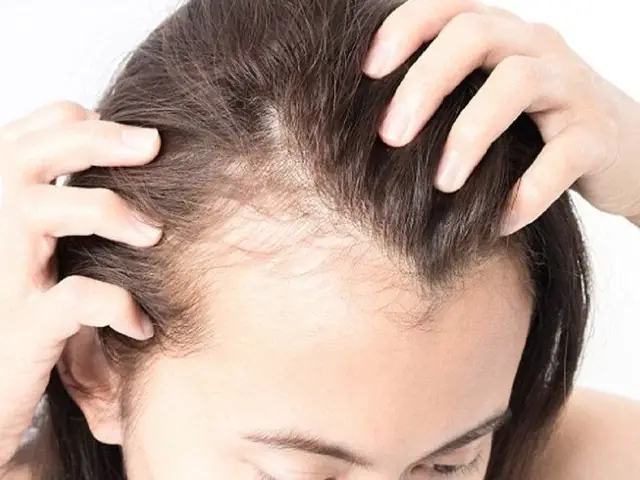 Chân Tóc Yếu Dễ Rụng: Nguyên Nhân, Dấu Hiệu Và Cách Phục Hồi Hiệu Quả