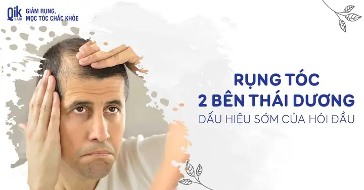 "rụng Tóc Không Ai Muốn": Nguyên Nhân, Cách Khắc Phục Hiệu Quả Và Phòng Ngừa "rụng Tóc Không Ai Muốn": Nguyên Nhân, Cách Khắc Phục Hiệu Quả Và Phòng Ngừa