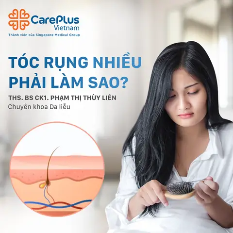 "rụng Tóc Không Ai Muốn": Nguyên Nhân, Cách Khắc Phục Hiệu Quả Và Phòng Ngừa "rụng Tóc Không Ai Muốn": Nguyên Nhân, Cách Khắc Phục Hiệu Quả Và Phòng Ngừa