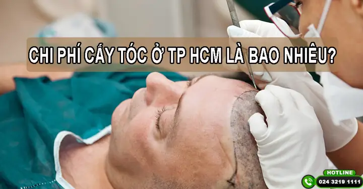 Chi Phí Cấy Tóc Tại Tphcm: Bảng Giá Chi Tiết & Yếu Tố Ảnh Hưởng 2026 Chi Phí Cấy Tóc Tại Tphcm: Bảng Giá Chi Tiết & Yếu Tố Ảnh Hưởng 2026
