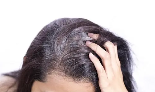 Chữa Tóc Bạc Sớm Ở Đâu Uy Tín: Khám & Điều Trị Tại Bệnh Viện, Phòng Khám Tốt Nhất Chữa Tóc Bạc Sớm Ở Đâu Uy Tín: Khám & Điều Trị Tại Bệnh Viện, Phòng Khám Tốt Nhất