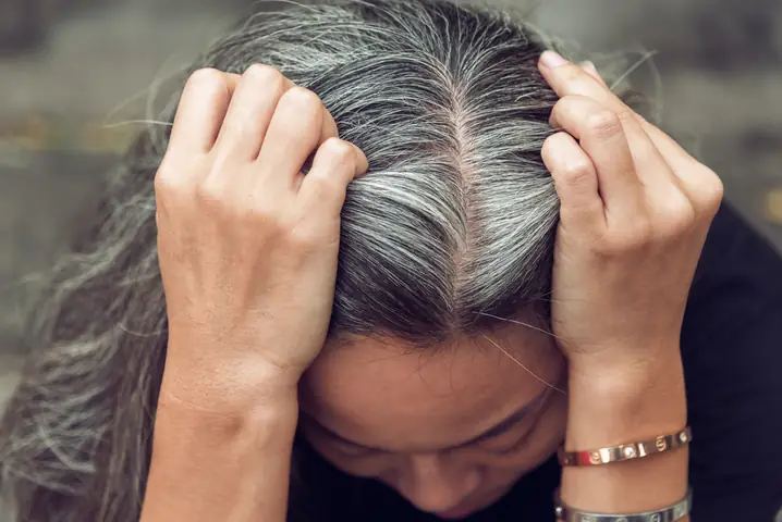Chữa Tóc Bạc Sớm Ở Đâu Uy Tín: Khám & Điều Trị Tại Bệnh Viện, Phòng Khám Tốt Nhất Chữa Tóc Bạc Sớm Ở Đâu Uy Tín: Khám & Điều Trị Tại Bệnh Viện, Phòng Khám Tốt Nhất