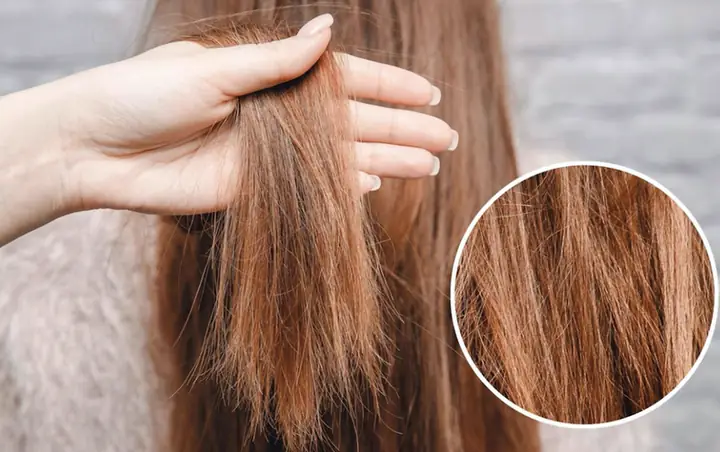 Có Nên Đi Phục Hồi Tóc Không? Ưu Nhược Điểm Và Khi Nào Cần Thiết Có Nên Đi Phục Hồi Tóc Không? Ưu Nhược Điểm Và Khi Nào Cần Thiết