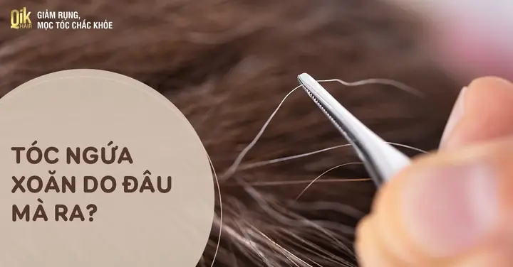Có Nên Nhổ Tóc Xoăn Ngứa Không? Bác Sĩ Giải Đáp Tác Hại Và Cách Xử Lý Đúng Có Nên Nhổ Tóc Xoăn Ngứa Không? Bác Sĩ Giải Đáp Tác Hại Và Cách Xử Lý Đúng