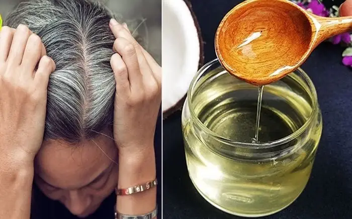 Tóc Bạc Sớm Tuổi Dậy Thì: Nguyên Nhân, Cách Khắc Phục Và Ngăn Ngừa Hiệu Quả Tóc Bạc Sớm Tuổi Dậy Thì: Nguyên Nhân, Cách Khắc Phục Và Ngăn Ngừa Hiệu Quả