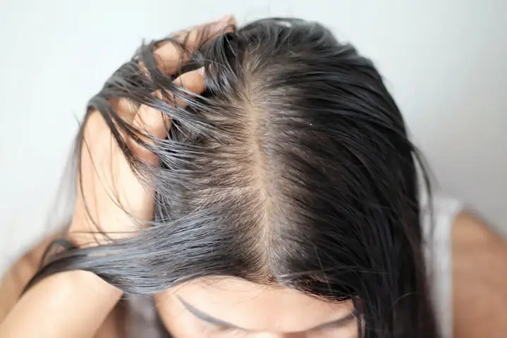 Da Đầu Dầu Nhưng Tóc Khô: Nguyên Nhân Và Bí Quyết Chăm Sóc Tóc Toàn Diện
