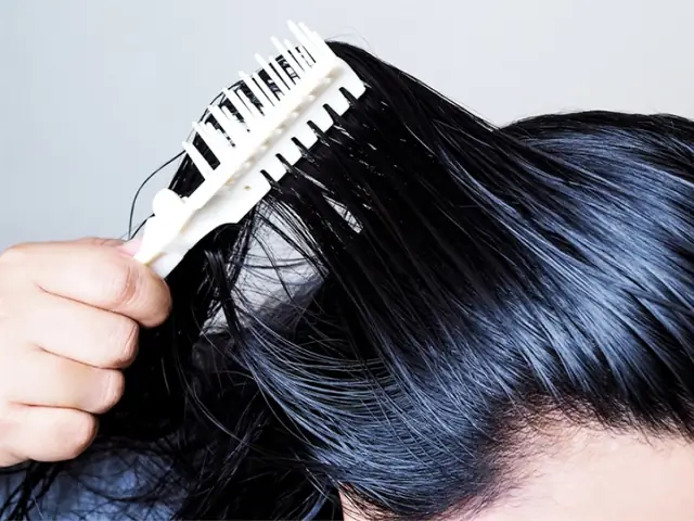 Da Đầu Dầu, Tóc Bết Dính: Nguyên Nhân & 7+ Cách Khắc Phục Tận Gốc Tại Nhà Da Đầu Dầu, Tóc Bết Dính: Nguyên Nhân & 7+ Cách Khắc Phục Tận Gốc Tại Nhà