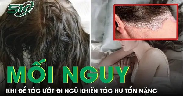 Để Tóc Ướt Đi Ngủ: Tác Hại Thực Sự & Cách Phòng Tránh Hiệu Quả Để Tóc Ướt Đi Ngủ: Tác Hại Thực Sự & Cách Phòng Tránh Hiệu Quả