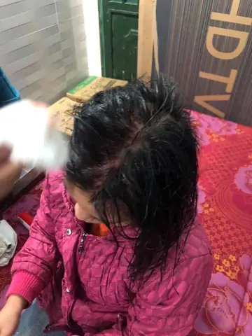Bị Chồng Đánh Khi Đi Làm Tóc: Nguyên Nhân, Hậu Quả Và Cách Ứng Phó Bị Chồng Đánh Khi Đi Làm Tóc: Nguyên Nhân, Hậu Quả Và Cách Ứng Phó