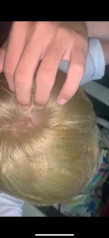 Dị Ứng Thuốc Nhuộm Tóc: Triệu Chứng, Nguyên Nhân Và Cách Xử Lý An Toàn