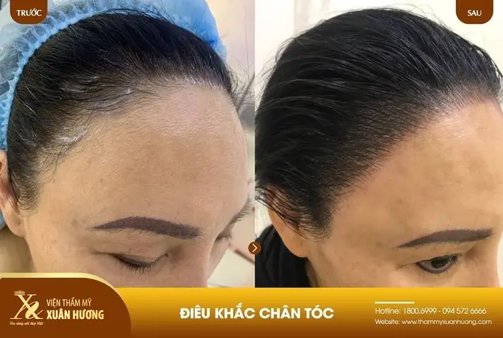 Điêu Khắc Chân Tóc: Giải Đáp "có Tốt Không" & Toàn Diện Lợi Ích, Rủi Ro Điêu Khắc Chân Tóc: Giải Đáp "có Tốt Không" & Toàn Diện Lợi Ích, Rủi Ro
