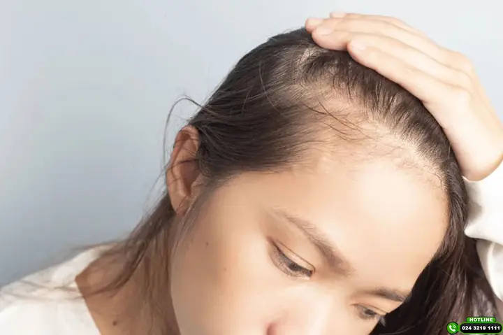 Đường Chân Tóc Chữ M: Ý Nghĩa, Kiểu Tóc Phù Hợp Và Cách Khắc Phục Hiệu Quả Đường Chân Tóc Chữ M: Ý Nghĩa, Kiểu Tóc Phù Hợp Và Cách Khắc Phục Hiệu Quả