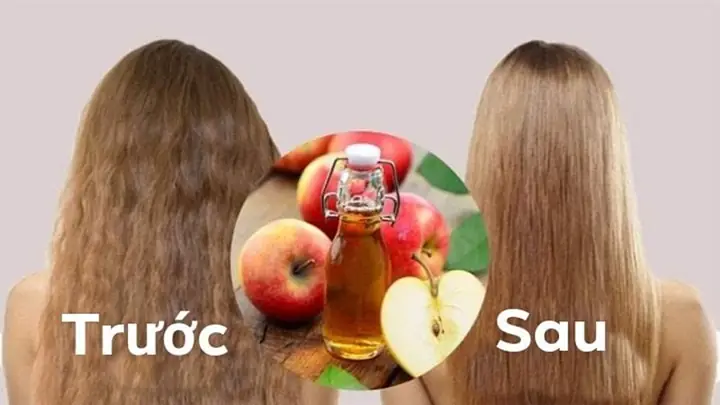 Giấm Táo Trị Rụng Tóc: Hiệu Quả, Cách Dùng & Lưu Ý An Toàn
