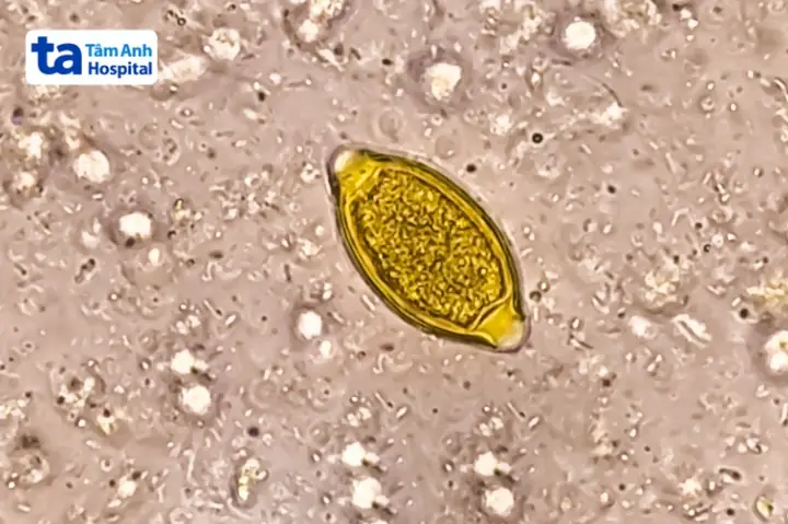 Giun Tóc (trichuris Trichiura): Tên Khoa Học, Đặc Điểm Và Tác Hại