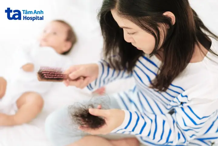 Hạn Chế Rụng Tóc Sau Sinh: Bí Quyết Phục Hồi Mái Tóc Chắc Khỏe Cho Mẹ Bỉm