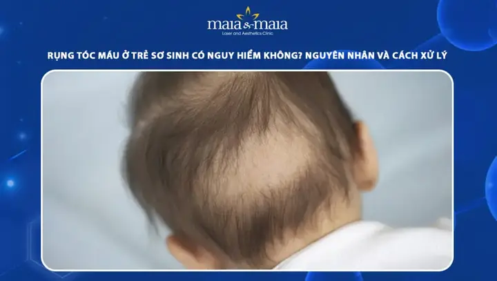 Rụng Tóc Máu Ở Trẻ Sơ Sinh: Hiện Tượng Bình Thường, Nguyên Nhân & Cách Xử Lý Đúng