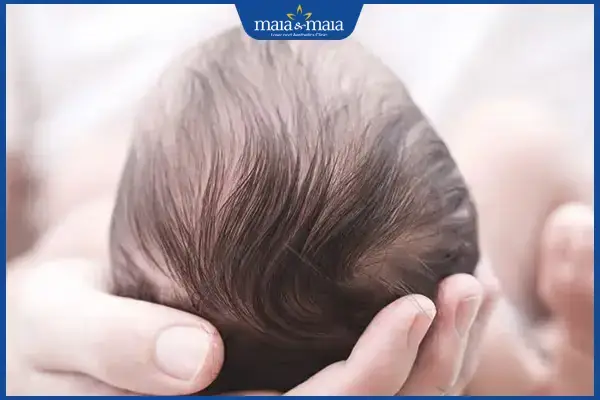Rụng Tóc Máu Ở Trẻ Sơ Sinh: Hiện Tượng Bình Thường, Nguyên Nhân & Cách Xử Lý Đúng