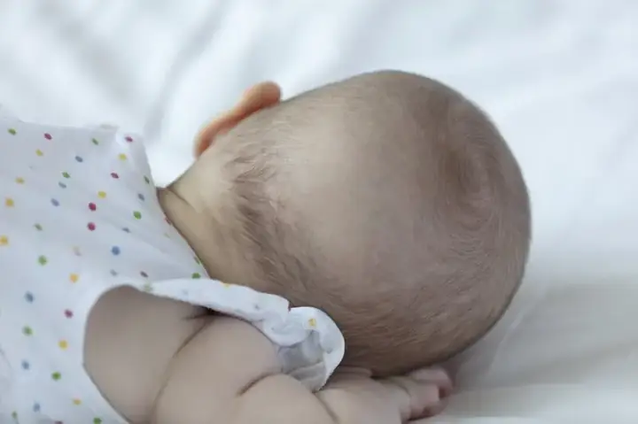 Rụng Tóc Máu Ở Trẻ Sơ Sinh: Hiện Tượng Bình Thường, Nguyên Nhân & Cách Xử Lý Đúng