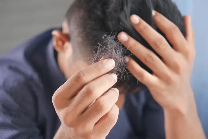 Rụng Tóc Ở Nam Giới: Nguyên Nhân, Dấu Hiệu & Cách Khắc Phục Toàn Diện Rụng Tóc Ở Nam Giới: Nguyên Nhân, Dấu Hiệu & Cách Khắc Phục Toàn Diện