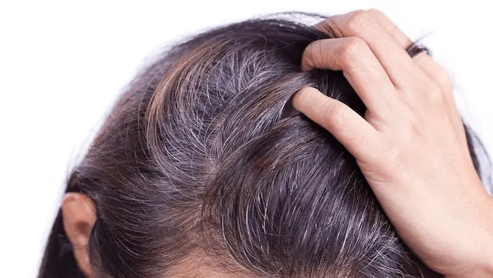 Hiện Tượng Tóc Bạc Sớm: Nguyên Nhân Sâu Xa Và Giải Pháp Toàn Diện Cho Mọi Lứa Tuổi